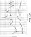 Fig. 20 - Cover-baffle-stand system for loudspeaker system and method of use thereof