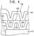 Fig. 04 - MEMS microphone and method of manufacturing the same