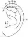 Fig. 01 - Connector for a hearing instrument, and hearing instrument
