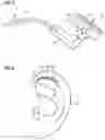 Fig. 03 - Connector for a hearing instrument, and hearing instrument