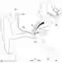 Fig. 01 - Bellows vibration body and hearing aid comprising same