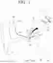Fig. 02 - Bellows vibration body and hearing aid comprising same