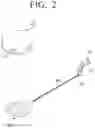 Fig. 03 - Bellows vibration body and hearing aid comprising same