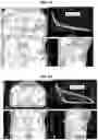 Fig. 12 - Techniques for particle beam therapy