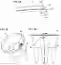 Fig. 08 - Insertable planter, system, and methods