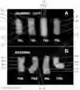 Fig. 01 - Wheat Lines, Plants, and Grain with Increased Beta-Glucan Content