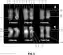 Fig. 04 - Wheat Lines, Plants, and Grain with Increased Beta-Glucan Content