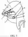 Fig. 04 - BITE PREVENTION TOWEL