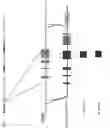 Fig. 02 - Genetically modified mouse expressing human APOE4 and mouse Trem2 p.R47H and methods of use thereof