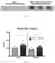 Fig. 03 - Genetically modified mouse expressing human APOE4 and mouse Trem2 p.R47H and methods of use thereof