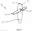 Fig. 02 - Sidetracker