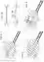 Fig. 03 - Insect swatting device