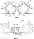 Fig. 04 - BRASSIERE WITH MODESTY ELEMENT