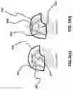 Fig. 08 - Rate-activated helmet suspension