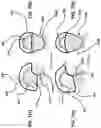 Fig. 09 - Rate-activated helmet suspension