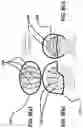 Fig. 10 - Rate-activated helmet suspension