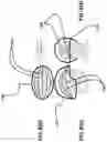 Fig. 11 - Rate-activated helmet suspension
