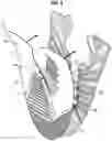 Fig. 05 - Upper for an article of footwear having an inner component and a shroud