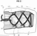 Fig. 06 - Upper for an article of footwear having an inner component and a shroud