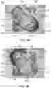 Fig. 05 - Transformable baby activity center with arch