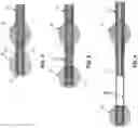 Fig. 03 - METHOD AND APPARATUS FOR PROVIDING INCREASED VISUALIZATION AND MANIPULATION OF A BODY SIDE WALL