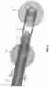 Fig. 04 - METHOD AND APPARATUS FOR PROVIDING INCREASED VISUALIZATION AND MANIPULATION OF A BODY SIDE WALL