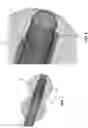 Fig. 06 - METHOD AND APPARATUS FOR PROVIDING INCREASED VISUALIZATION AND MANIPULATION OF A BODY SIDE WALL
