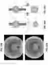 Fig. 22 - METHOD AND APPARATUS FOR PROVIDING INCREASED VISUALIZATION AND MANIPULATION OF A BODY SIDE WALL