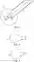 Fig. 03 - DIRECT VIEW OPTICAL CARDIAC CATHETER