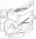 Fig. 07 - DIRECT VIEW OPTICAL CARDIAC CATHETER