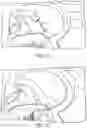 Fig. 10 - DIRECT VIEW OPTICAL CARDIAC CATHETER