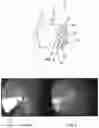 Fig. 04 - Device for shielding endoscopic optics with a fluid barrier