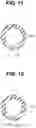 Fig. 08 - Insertion apparatus and operation method for insertion apparatus