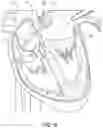 Fig. 07 - Devices and methods for mapping cardiac tissue