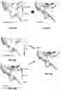 Fig. 13 - Devices and methods for mapping cardiac tissue