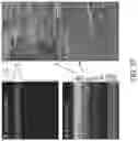 Fig. 45 - Ophthalmoscopy method