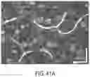 Fig. 49 - Ophthalmoscopy method