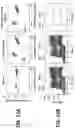 Fig. 67 - Ophthalmoscopy method