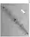 Fig. 04 - Body-worn sensor for characterizing patients with heart failure
