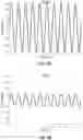 Fig. 14 - Systems and methods for performing electrophysiology (EP) signal processing