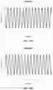 Fig. 29 - Systems and methods for performing electrophysiology (EP) signal processing