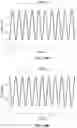 Fig. 30 - Systems and methods for performing electrophysiology (EP) signal processing