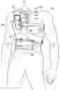Fig. 01 - System for the early detection of postoperative bleeding