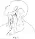 Fig. 09 - System for the early detection of postoperative bleeding