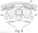 Fig. 10 - System for the early detection of postoperative bleeding