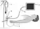 Fig. 01 - Automatic zeroing system and electronic level adjustment of pressure transducer applied to vital signs monitors