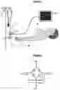 Fig. 02 - Automatic zeroing system and electronic level adjustment of pressure transducer applied to vital signs monitors