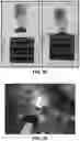 Fig. 41 - Encapsulated flexible electronics for long-term implantation