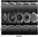 Fig. 65 - Encapsulated flexible electronics for long-term implantation