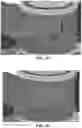 Fig. 12 - Methods and apparatus for patient positioning in magnetic resonance imaging